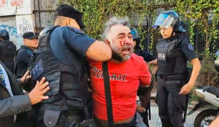 Tras ser atendido por el SAME, el camarógrafo quedó detenido y rápidamente fue detenido.