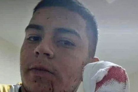 Martin Abraham fue asaltado: le tiraron un machetazo a la cabeza pero interpuso su mano para salvarse