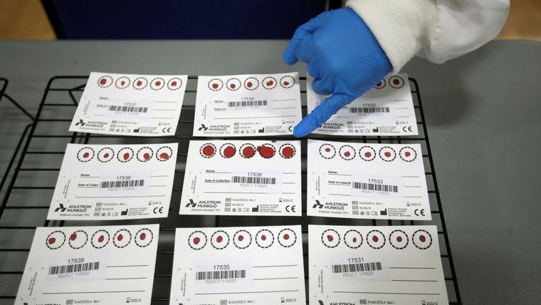 Muestras de sangre durante un ensayo clínico de pruebas de anticuerpos contra el covid-19, en Reino Unido, el 30 de junio de 2020. Foto: Reuters