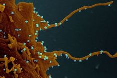 La célula infectada, siguiendo las instucciones del virus (en azul), desarrolla largos tentáculos para infectar otras células.