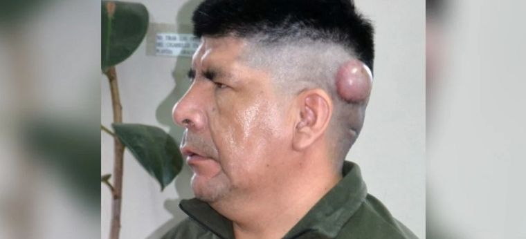 Violento femicidio en Jujuy Foto: Télam