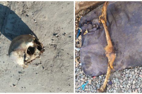 El hallazgo de huesos humanos en Maipú fue alertado por uno de los vecinos de la zona.