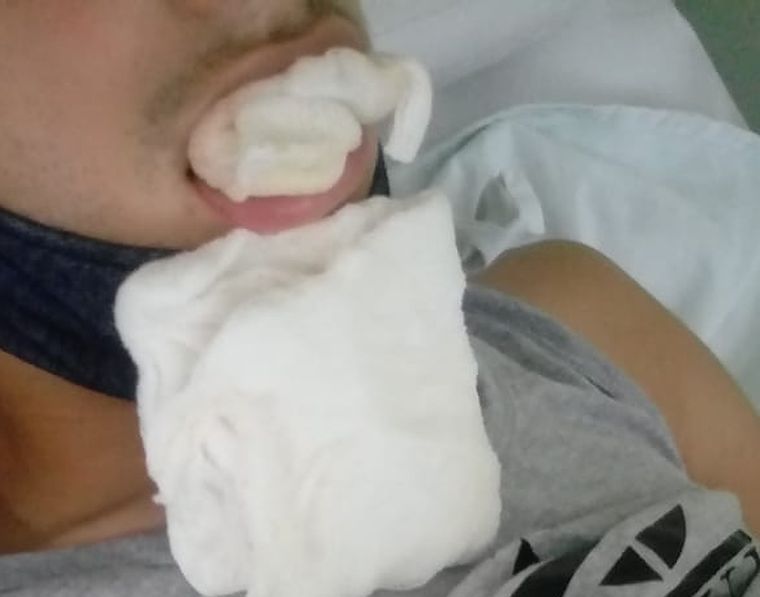 Facundo espera la operación de mandíbula para continuar su recuperación tras el violento ataque