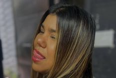 Camilota fue participante de Cuestión de peso. Es hermana de Thiago Medina, exconcursante de Gran Hermano.