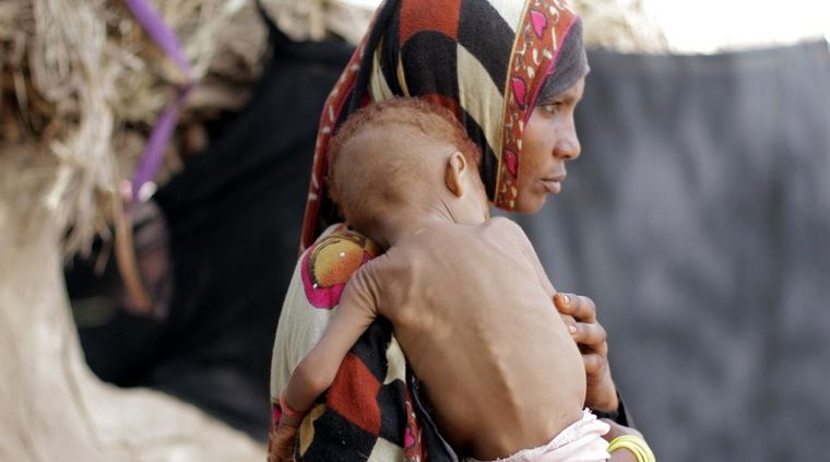 Yemen atraviesa una muy dura crisis humanitaria. Foto: AnnuTv.