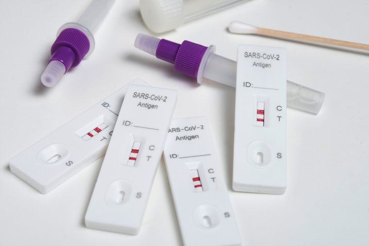 En Argentina se observa un incremento en la actividad del SARS-CoV-2 desde finales de julio, con un promedio de 1.751 casos y 11 fallecidos semanales Foto: Freepik