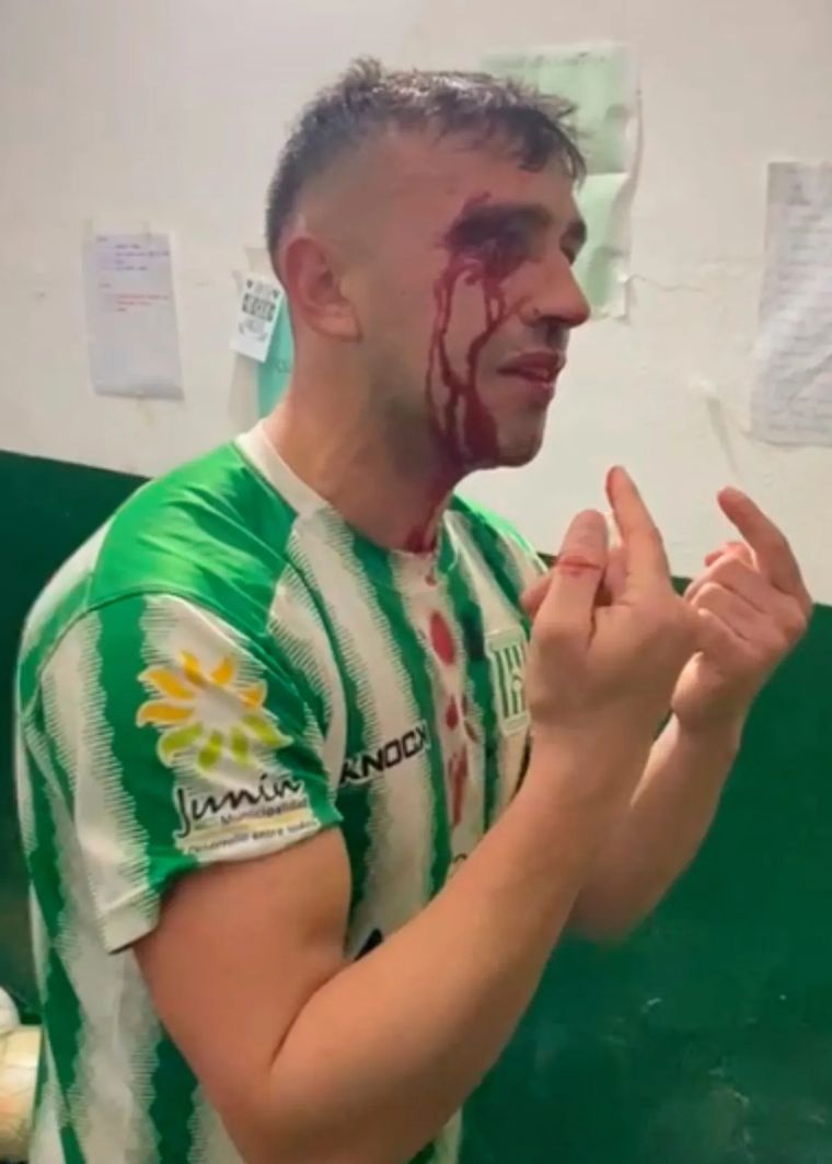 El rostro de Pacini, el jugador agredido.